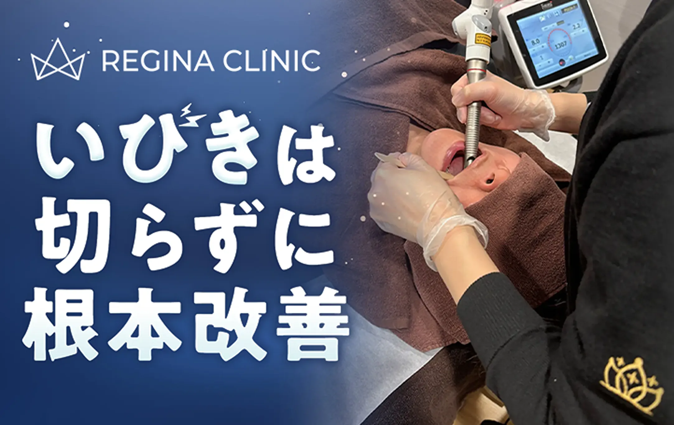 レジーナクリニックのいびき治療